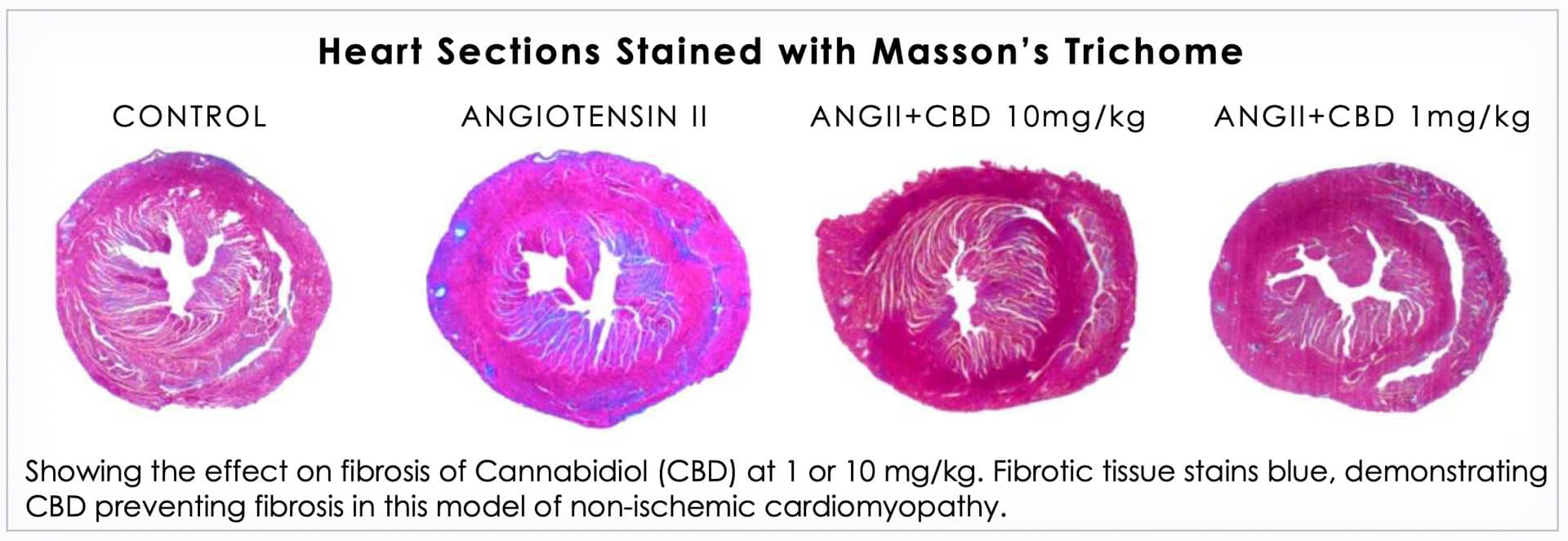 cannabidiol